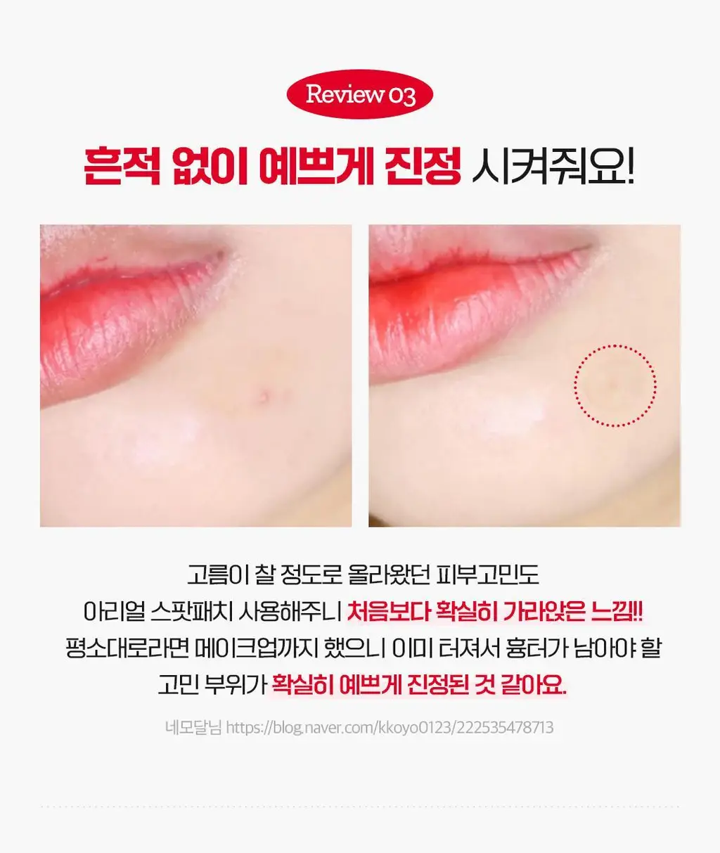 [피부고민케어]아리얼 트루 AC 스팟 패치 듀오 세트 106매 상세페이지 28